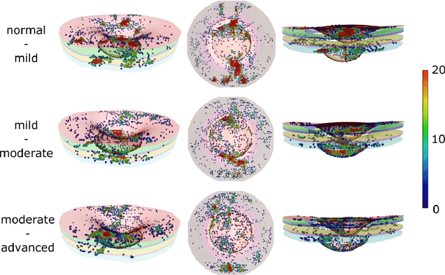 Figure 3 for The 3D Structural Phenotype of the Glaucomatous Optic Nerve Head and its Relationship with The Severity of Visual Field Damage