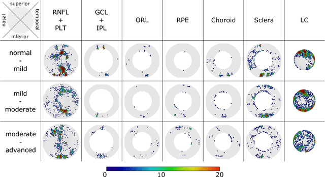 Figure 4 for The 3D Structural Phenotype of the Glaucomatous Optic Nerve Head and its Relationship with The Severity of Visual Field Damage