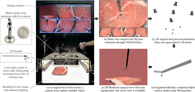 Figure 1 for EasyVis2: A Real Time Multi-view 3D Visualization for Laparoscopic Surgery Training Enhanced by a Deep Neural Network YOLOv8-Pose