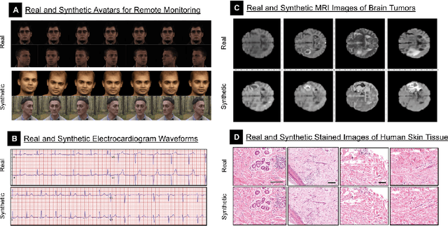 Figure 4 for Synthetic Data in Healthcare