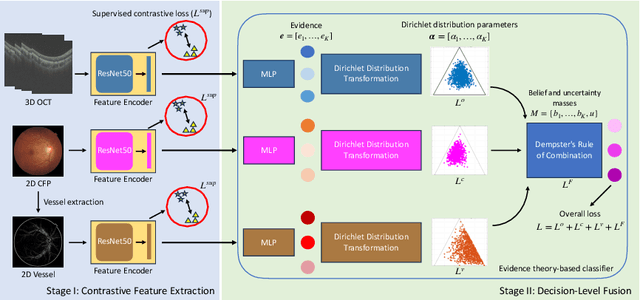 Figure 3 for ETSCL: An Evidence Theory-Based Supervised Contrastive Learning Framework for Multi-modal Glaucoma Grading