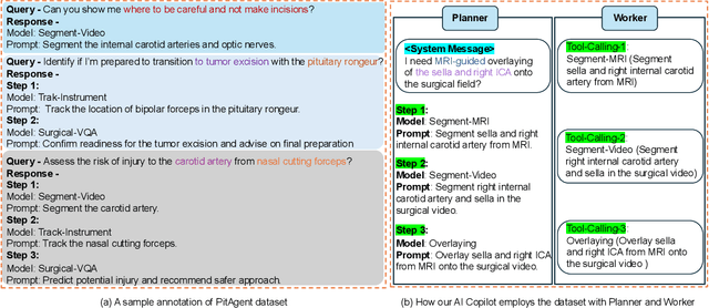 Figure 1 for SurgicalVLM-Agent: Towards an Interactive AI Co-Pilot for Pituitary Surgery