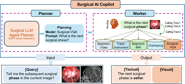 Figure 3 for SurgicalVLM-Agent: Towards an Interactive AI Co-Pilot for Pituitary Surgery