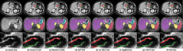 Figure 3 for Mamba Goes HoME: Hierarchical Soft Mixture-of-Experts for 3D Medical Image Segmentation