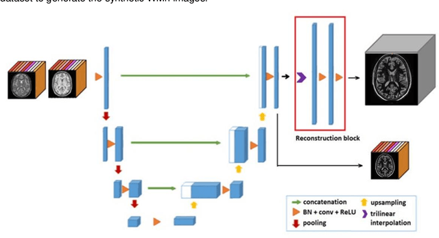 Figure 1 for DeepThalamus: A novel deep learning method for automatic segmentation of brain thalamic nuclei from multimodal ultra-high resolution MRI