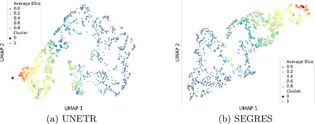 Figure 3 for Here Comes the Explanation: A Shapley Perspective on Multi-contrast Medical Image Segmentation