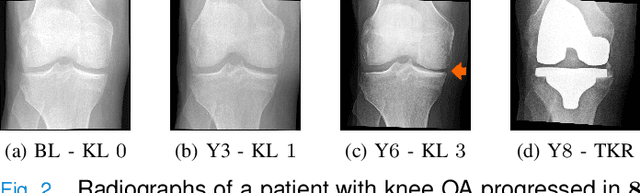 Figure 4 for Clinically-Inspired Multi-Agent Transformers for Disease Trajectory Forecasting from Multimodal Data