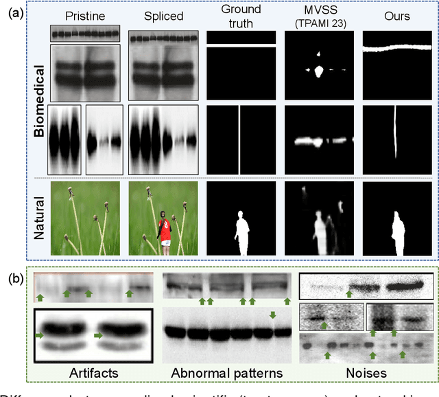 Figure 1 for Biomedical Image Splicing Detection using Uncertainty-Guided Refinement