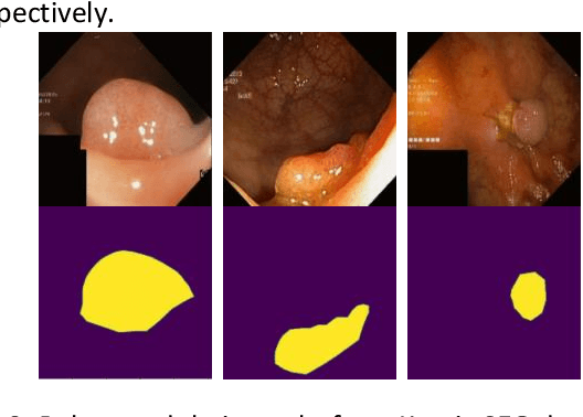 Figure 2 for Multi Kernel Positional Embedding ConvNeXt for Polyp Segmentation