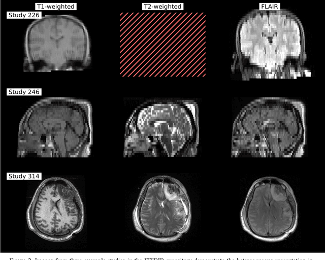 Figure 2 for Phenotype discovery of traumatic brain injury segmentations from heterogeneous multi-site data