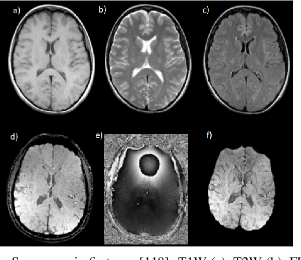 Figure 4 for Review of methods for automatic cerebral microbleeds detection