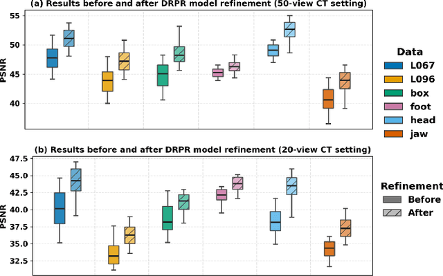 Figure 2 for Iterative Diffusion-Refined Neural Attenuation Fields for Multi-Source Stationary CT Reconstruction: NAF Meets Diffusion Model