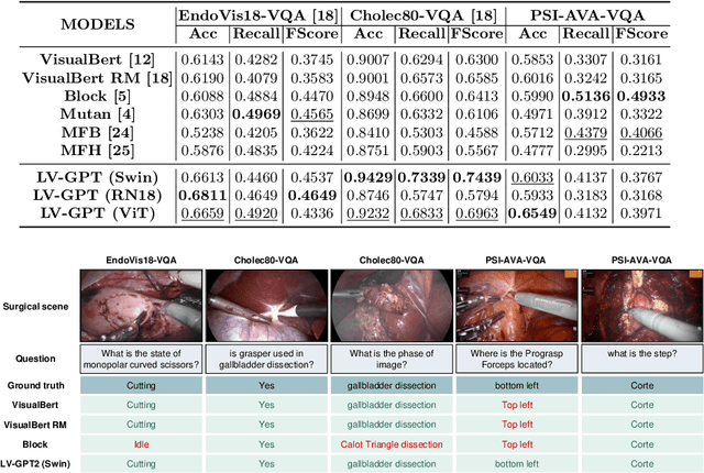 Figure 2 for SurgicalGPT: End-to-End Language-Vision GPT for Visual Question Answering in Surgery