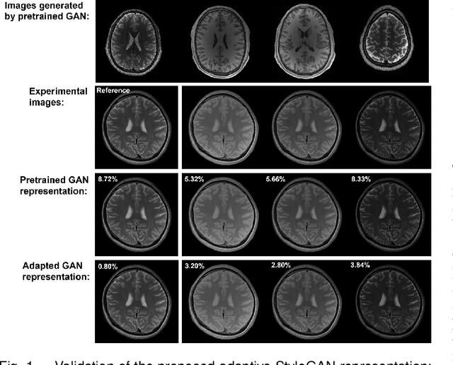 Figure 1 for High-Dimensional MR Reconstruction Integrating Subspace and Adaptive Generative Models