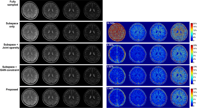 Figure 3 for High-Dimensional MR Reconstruction Integrating Subspace and Adaptive Generative Models