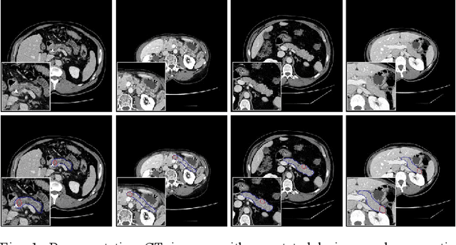 Figure 1 for A Dual-Task Synergy-Driven Generalization Framework for Pancreatic Cancer Segmentation in CT Scans