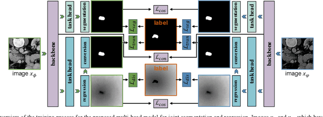 Figure 3 for A Dual-Task Synergy-Driven Generalization Framework for Pancreatic Cancer Segmentation in CT Scans