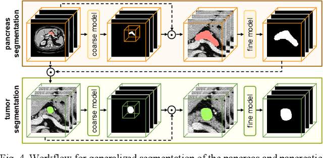 Figure 4 for A Dual-Task Synergy-Driven Generalization Framework for Pancreatic Cancer Segmentation in CT Scans