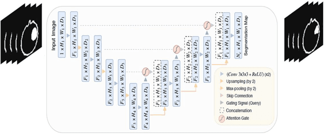 Figure 2 for Attention U-net approach in predicting Intensity Modulated Radiation Therapy dose distribution in brain glioma tumor