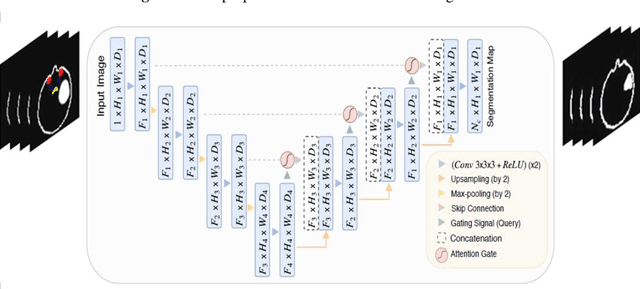 Figure 3 for Attention U-net approach in predicting Intensity Modulated Radiation Therapy dose distribution in brain glioma tumor