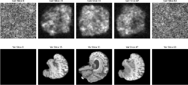 Figure 3 for Bringing together invertible UNets with invertible attention modules for memory-efficient diffusion models