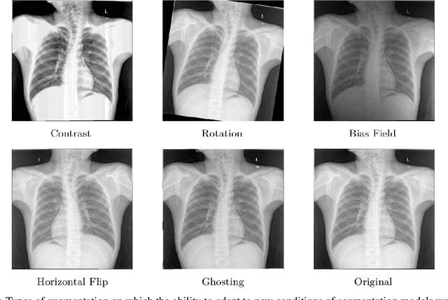 Figure 1 for A comparative analysis of deep learning models for lung segmentation on X-ray images