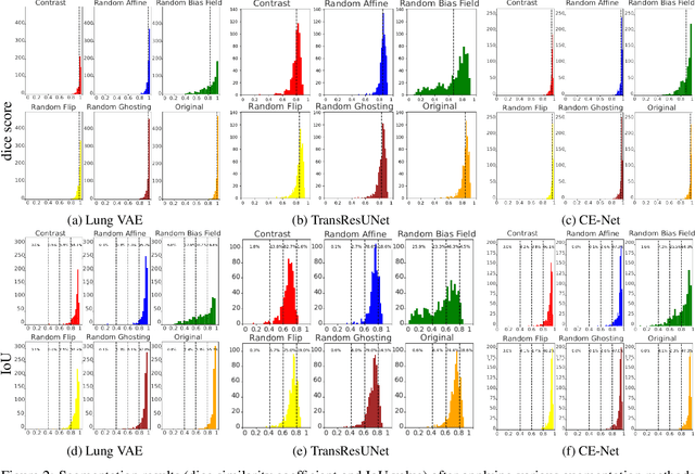 Figure 2 for A comparative analysis of deep learning models for lung segmentation on X-ray images