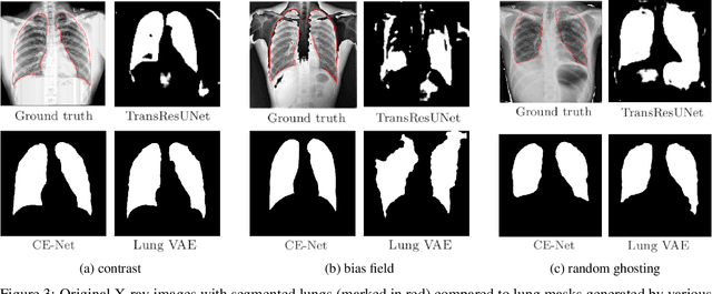 Figure 3 for A comparative analysis of deep learning models for lung segmentation on X-ray images