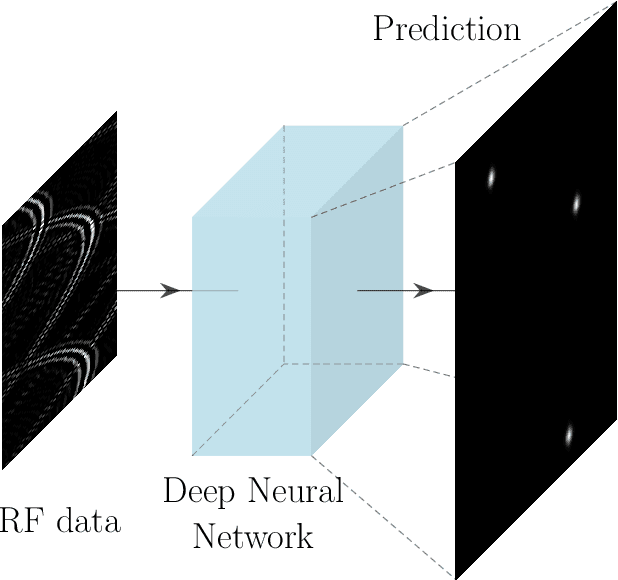 Figure 1 for Learning Super-Resolution Ultrasound Localization Microscopy from Radio-Frequency Data