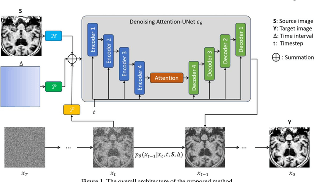 Figure 1 for Conditional Diffusion Model for Longitudinal Medical Image Generation