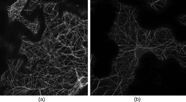 Figure 1 for A Conditional Generative Framework for Synthetic Data Augmentation in Segmenting Thin and Elongated Structures in Biological Images