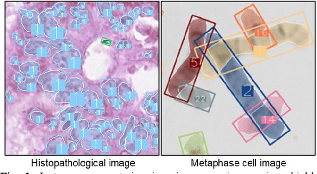 Figure 1 for Skeleton-Guided Instance Separation for Fine-Grained Segmentation in Microscopy