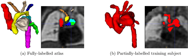 Figure 1 for Multi-task learning for joint weakly-supervised segmentation and aortic arch anomaly classification in fetal cardiac MRI