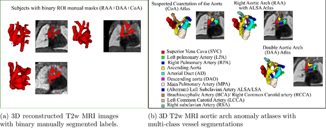 Figure 4 for Multi-task learning for joint weakly-supervised segmentation and aortic arch anomaly classification in fetal cardiac MRI