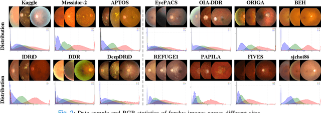 Figure 2 for Graph-Guided Test-Time Adaptation for Glaucoma Diagnosis using Fundus Photography