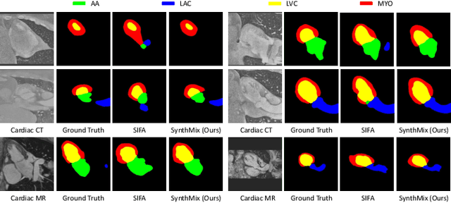 Figure 3 for SynthMix: Mixing up Aligned Synthesis for Medical Cross-Modality Domain Adaptation