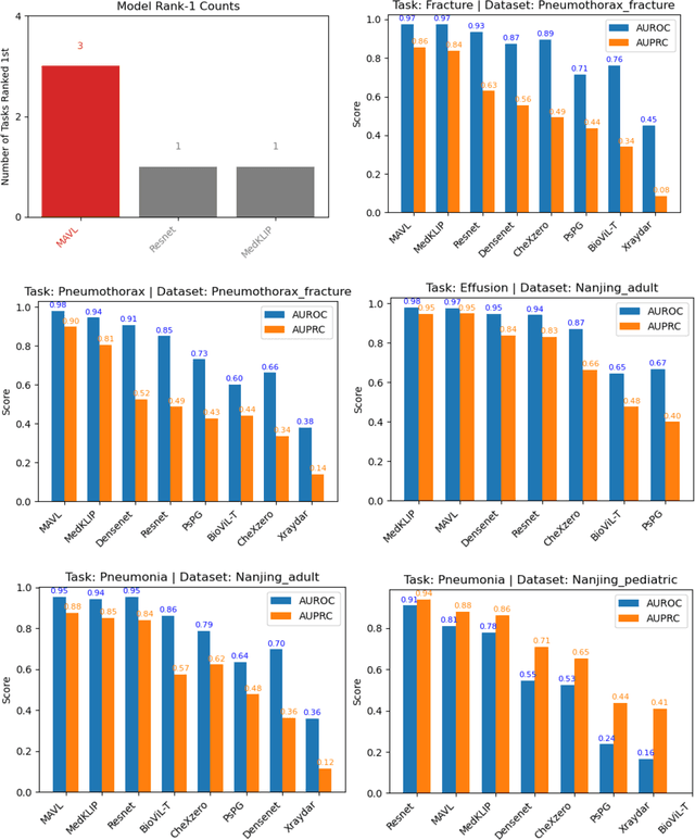 Figure 3 for Benchmarking Chest X-ray Diagnosis Models Across Multinational Datasets