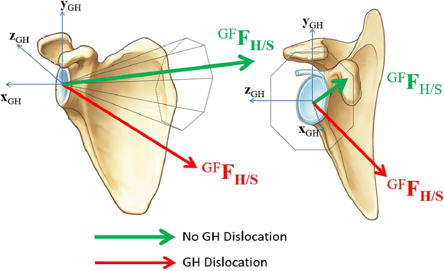 Figure 1 for Simulation Study of the Upper-limb Wrench Feasible Set with Glenohumeral Joint Constraints