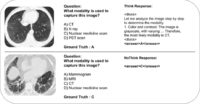 Figure 3 for SafeMed-R1: Adversarial Reinforcement Learning for Generalizable and Robust Medical Reasoning in Vision-Language Models