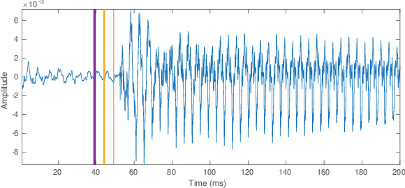 Figure 3 for Development of Large Annotated Music Datasets using HMM-based Forced Viterbi Alignment