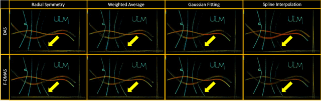 Figure 3 for A Performance Evaluation of Filtered Delay Multiply and Sum Beamforming for Ultrasound Localization Microscopy: Preliminary Results