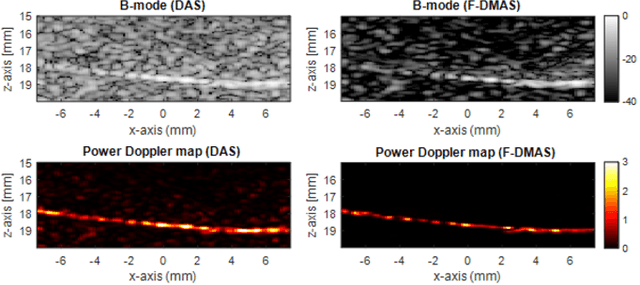 Figure 4 for A Performance Evaluation of Filtered Delay Multiply and Sum Beamforming for Ultrasound Localization Microscopy: Preliminary Results
