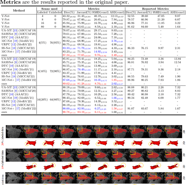 Figure 2 for Correlation-Aware Mutual Learning for Semi-supervised Medical Image Segmentation
