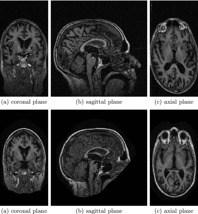 Figure 1 for Application of Unsupervised Domain Adaptation for Structural MRI Analysis