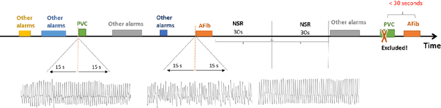 Figure 2 for Cluster consistency: Simple yet effect robust learning algorithm on large-scale photoplethysmography for atrial fibrillation detection in the presence of real-world label noise