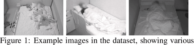 Figure 2 for SlAction: Non-intrusive, Lightweight Obstructive Sleep Apnea Detection using Infrared Video