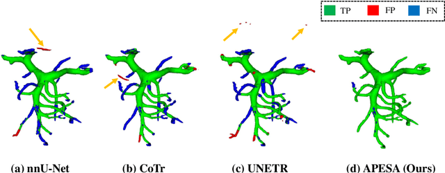 Figure 3 for Automated Peripancreatic Vessel Segmentation and Labeling Based on Iterative Trunk Growth and Weakly Supervised Mechanism