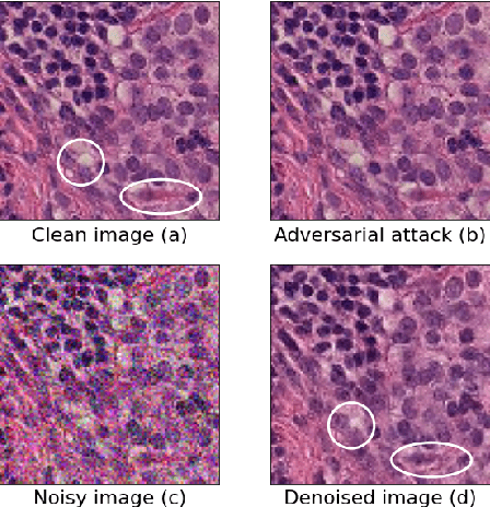 Figure 2 for Denoising Diffusion Probabilistic Models as a Defense against Adversarial Attacks