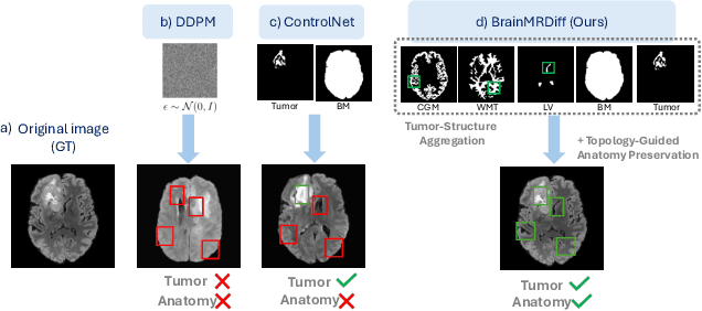 Figure 1 for BrainMRDiff: A Diffusion Model for Anatomically Consistent Brain MRI Synthesis