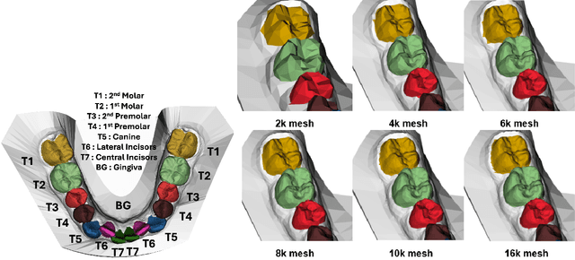 Figure 3 for Evaluating the Suitability of Different Intraoral Scan Resolutions for Deep Learning-Based Tooth Segmentation